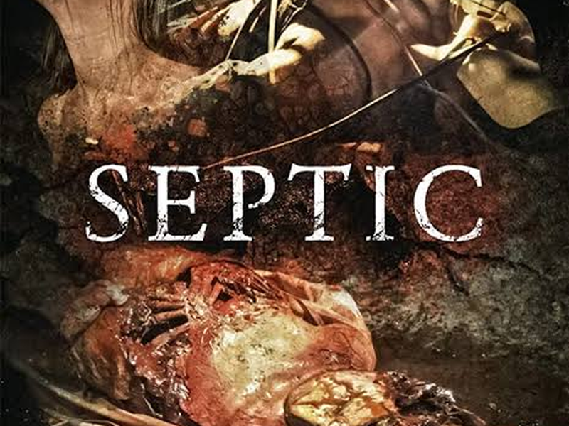 Foto 1 de Séptico