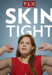 Emagreci, e Agora? (Skin Tight)