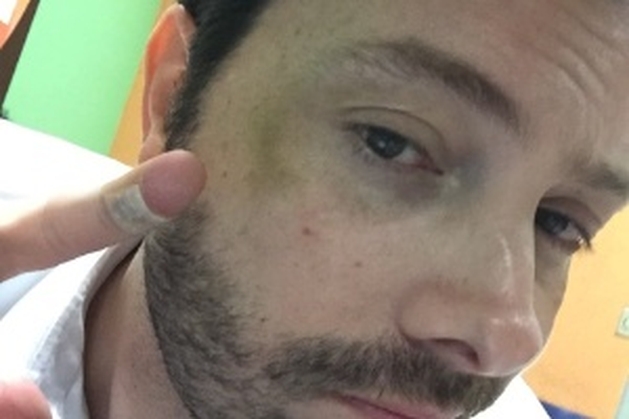 Danilo Gentili se machuca em cena de luta na filmagem de seu primeiro longa - NotÃ­cias - UOL Cinema