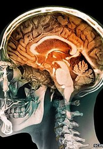 Seu Cérebro é Masculino ou Feminino? (Is Your Brain Male or Female?)