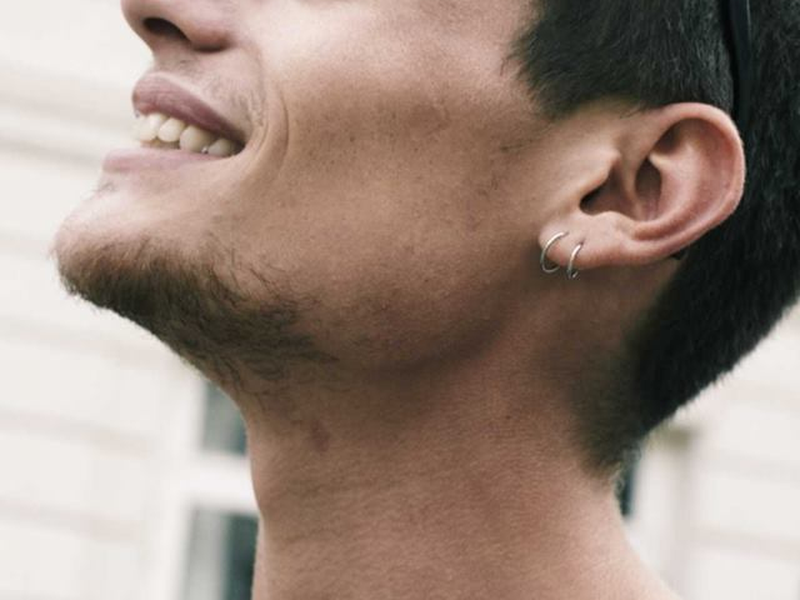 Foto 1 de Algo está Queimando