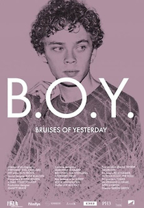 B.O.Y. - Bruises of Yesterday (Glasskår)