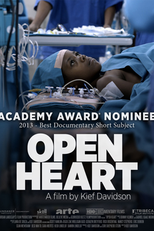 Open Heart (Open Heart)