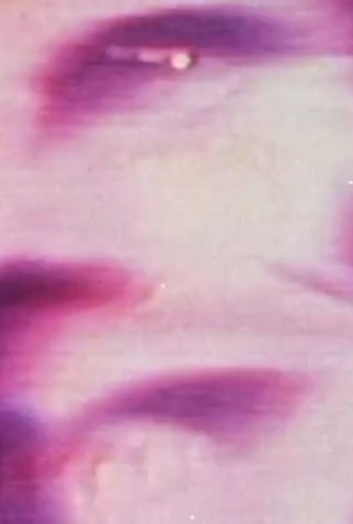 Poster 1 de Curta Plastic Surgery (1975)
