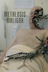 Metalosis Maligna (Metalosis Maligna)